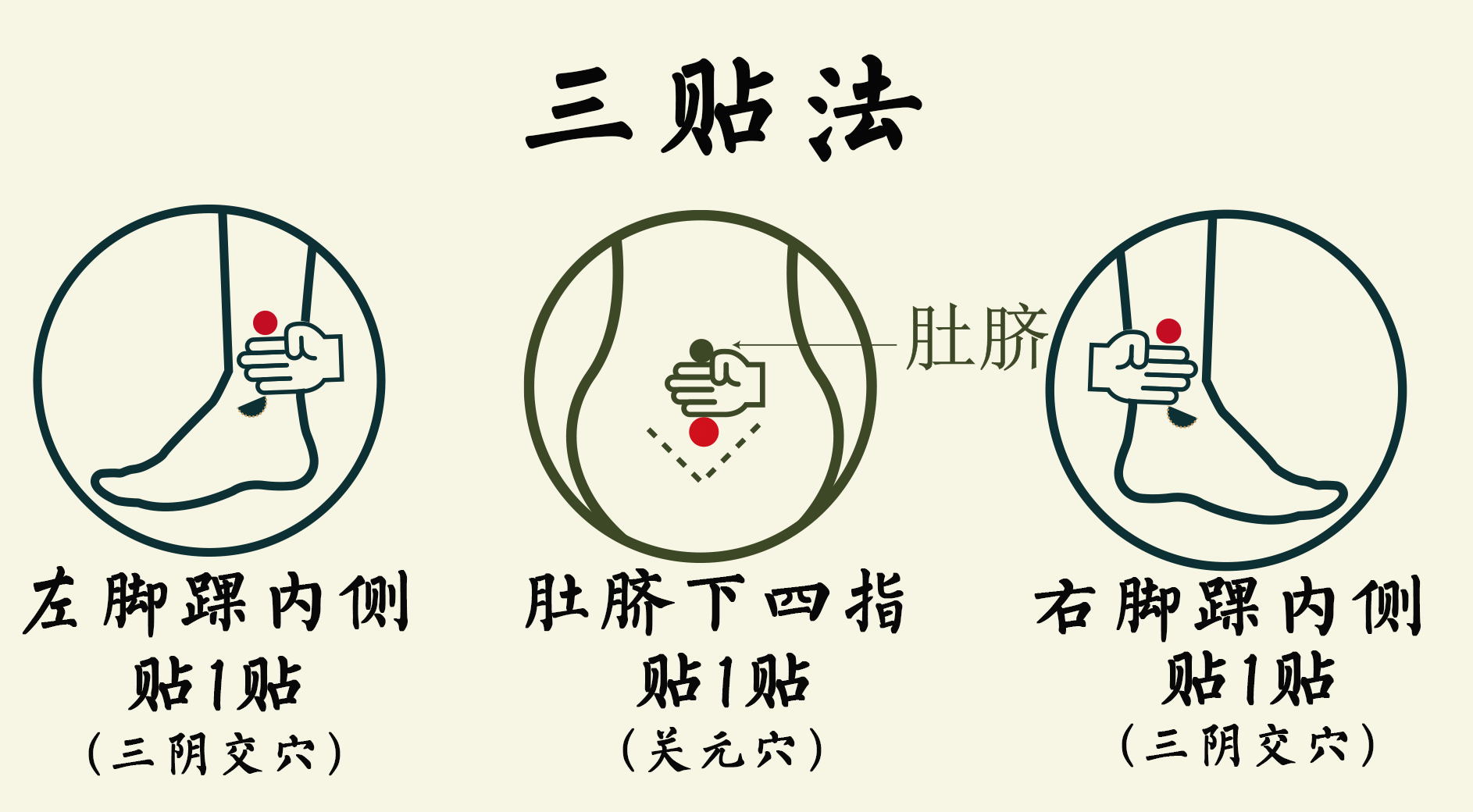 三贴法定位示意图